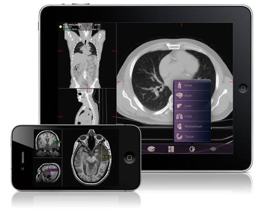 FDAͨ�^�ׂ��t(y��)���\����(y��ng)�ó���Mobile MIM